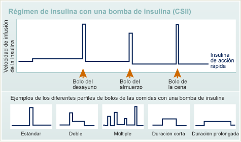 Régimen de insulina con una bomba de insulina (CSII)